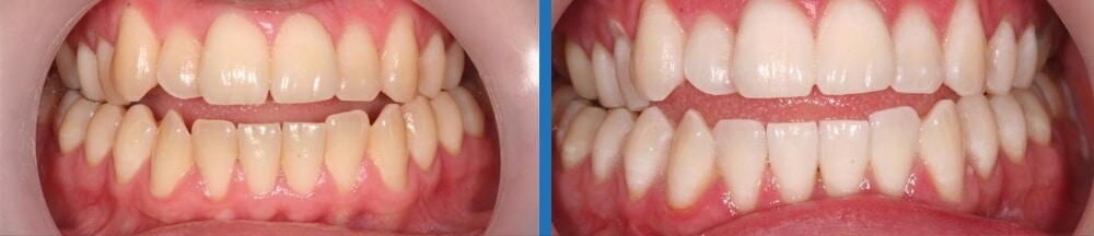 cazuistica clinica stomatologica Smart Dental, Cluj-Napoca